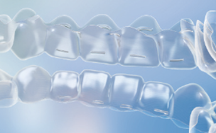 10代の矯正治療