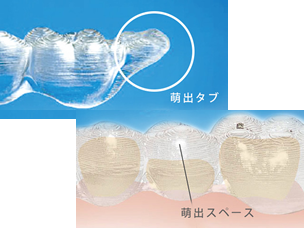 10代の矯正治療