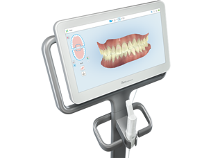 10代の矯正治療